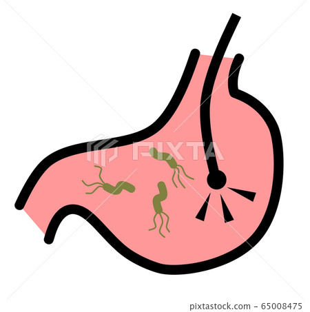 Gastroscope 65008475