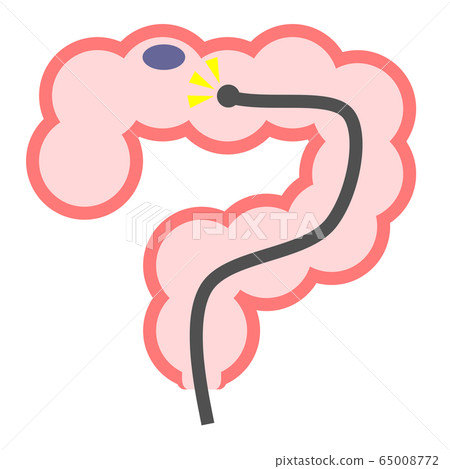 Colon camera 65008772