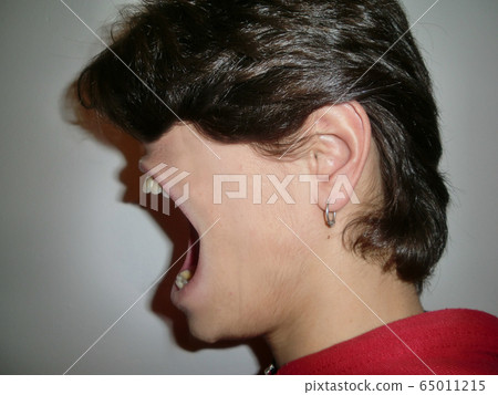 Shouting anxiety 65011215