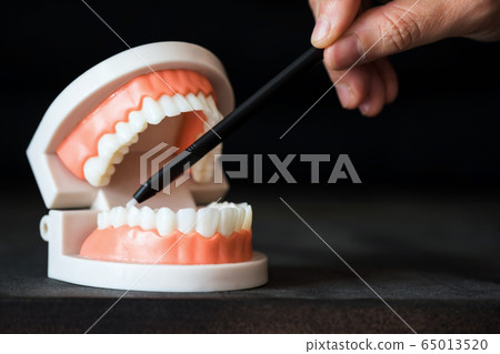 Dentist point pen to lower molar tooth Dentist point pen to lower molar tooth 65013520