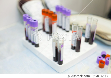 laboratory test tubes fullfilled with different laboratory test tubes fullfilled with different 65016317