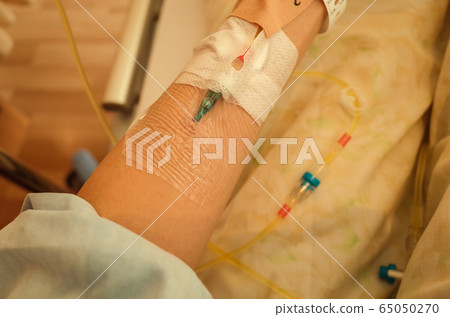 Arm to drip Arm to drip 65050270