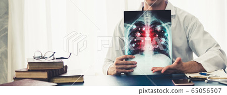 Doctor analyze Coronavirus Disease 2019 or Doctor analyze Coronavirus Disease 2019 or 65056507