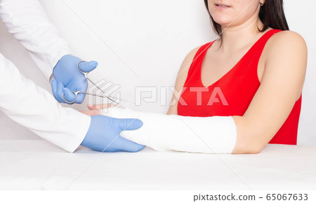 Doctor traumatologist cuts a plaster cast of a young girl on her arm with a fracture of the radius without displacement, copy space Doctor traumatologist cuts a plaster cast of a young girl on her arm with a fracture of the radius without displacement, copy space 65067633