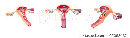 Mock female reproductive system on a white background, isolate. Fallopian tubes and ovaries, close-up 65068482