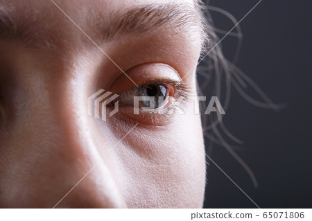Shot of young woman's face without make-up Shot of young woman's face without make-up 65071806