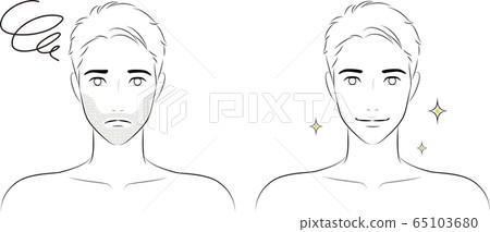 Male face mustache hair removal 65103680