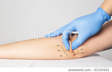Doctor plastic surgeon examines the skin on the patient's elbow. The concept of plastic surgery and skin tightening on the hands, copy space Doctor plastic surgeon examines the skin on the patient's elbow. The concept of plastic surgery and skin tightening on the hands, copy space 65105082