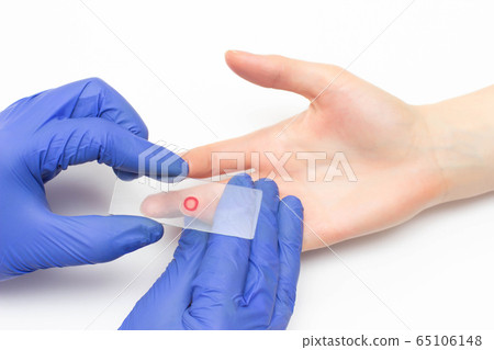 The doctor takes blood from his finger General clinical analysis for the study of the blood of the immune system and plasma, close-up, immunoglobulin 65106148