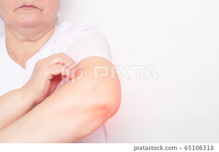Woman holding her elbow joint, inflammation and pain in the elbow joint, tendens and bursitis, white background, copy space Woman holding her elbow joint, inflammation and pain in the elbow joint, tendens and bursitis, white background, copy space 65106318