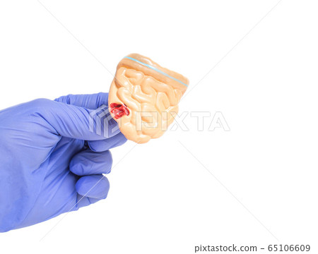 Doctor holds a mock intestines of a man on a white background. The concept of intestinal diseases and the treatment of colitis and enteritis, copy space 65106609