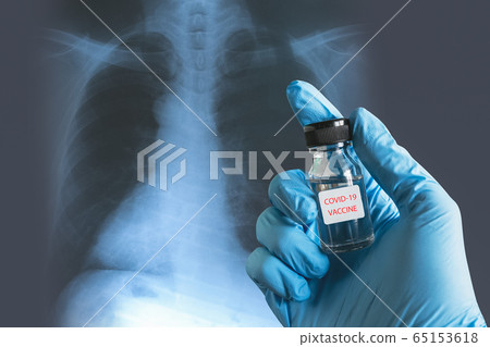 Coronavirus covid-19 infected blood sample tube in 65153618