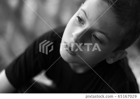 Portrait of a child with a cerebral palsy. Close-up 65167029