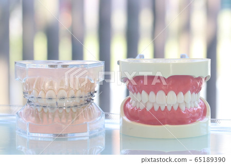 Dental model 65189390