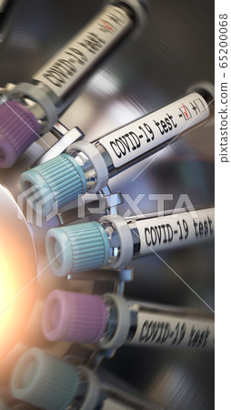 Negative COVID-19 test and laboratory sample of blood testing for diagnosis new Corona virus infection novel corona virus disease 2019 from Wuhan. Pandemic infectious concept 3D 65200068