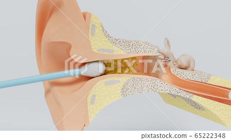 3d render ear cleansing earwax ear stick. 3d illustration 65222348
