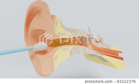3d render ear cleansing earwax ear stick. 3d illustration 65222376