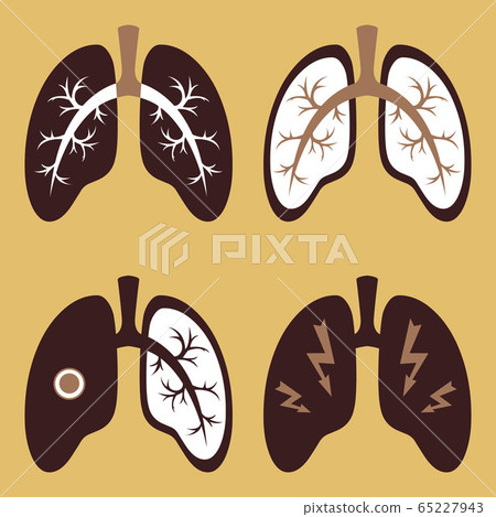 Vector image of the respiratory tract. Icons of the lung organ that can be used as a web design template. COVID-19 virus. Prevention of coronavirus. Vector image of the respiratory tract. Icons of the lung organ that can be used as a web design template. COVID-19 virus. Prevention of coronavirus. 65227943