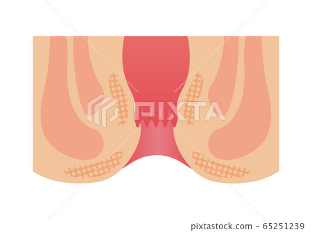 Structural cross-sectional illustration of the anus and rectum (human body / medical) / without letters 65251239