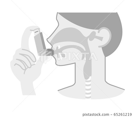 Illustration of a person who breathes in asthma inhalants (sartanol, chart, no arrows, black and white) 65261219