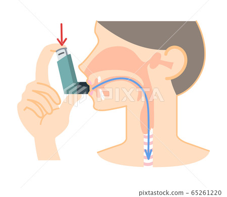 吸入哮喘吸入劑的人的插圖（沙坦醇，圖表，箭頭） 65261220