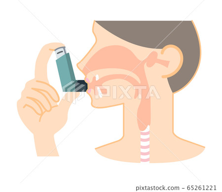 吸入哮喘吸入劑的人的插圖（沙特諾爾，圖表，無箭頭） 65261221