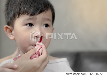 Portrait of cute Asian ethnic child having nosebleed,The concept of first aid for nosebleeds. Portrait of cute Asian ethnic child having nosebleed,The concept of first aid for nosebleeds. 65316729