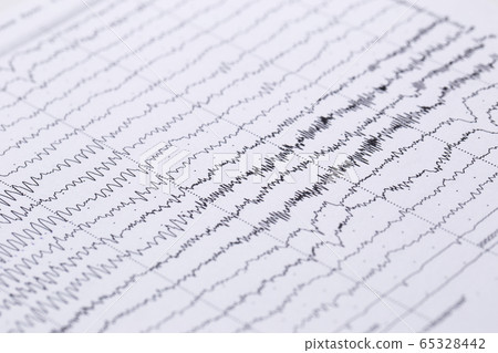 Cardiogram on a sheet of paper close-up. Texture of pulsed waves. 65328442