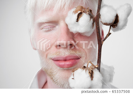 portrait of an albino man in studio dressed 65337508