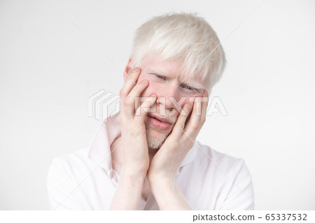 portrait of an albino man in studio dressed portrait of an albino man in studio dressed 65337532
