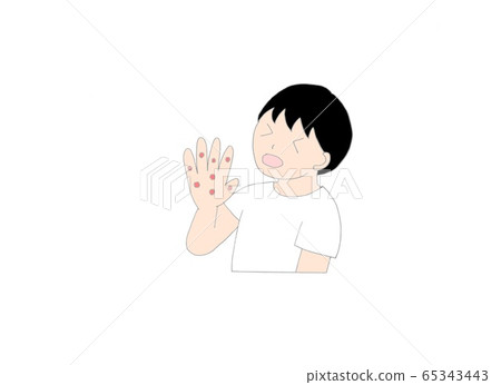 Hand-foot-and-mouth disease  65343443