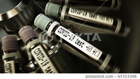 Vials of blood in a centrifuge. Negative COVID-19 test and laboratory sample of blood testing for diagnosis new Corona virus infection novel corona virus disease 2019 from Wuhan. Pandemic infectious 65353306