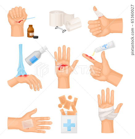 Hands with Injured Skin and Procedures of... - Stock Illustration ...