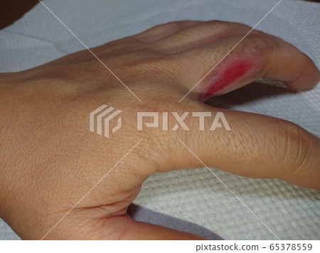 燃燒自己 65378559