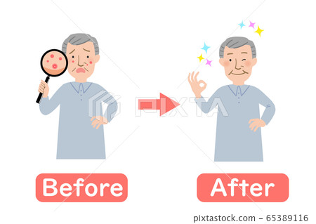 Grandpa's Before After with a breakout on his face Grandpa's Before After with a breakout on his face 65389116