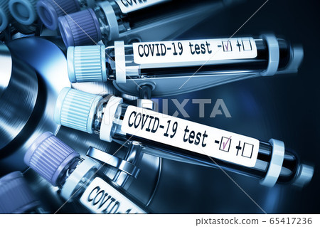 Coronaviruses research, conceptual illustration. Negative COVID-19 test and laboratory sample of blood tasting for diagnosis new Corona virus infection. 3D 65417236