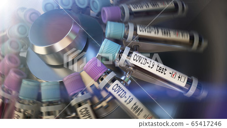 Negative COVID-19 test and laboratory sample of blood testing for diagnosis new Corona virus infection novel corona virus disease 2019 from Wuhan. Pandemic infectious concept 3D 65417246