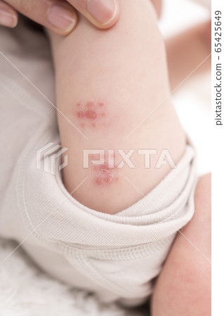 郵票注入 65425649