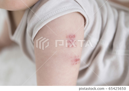 郵票注入 65425650