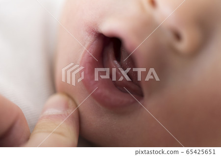 阿卡的牙齒 阿卡的牙齒 65425651