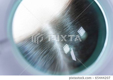 Caucasian womans hair being checked by a doctor 65444207