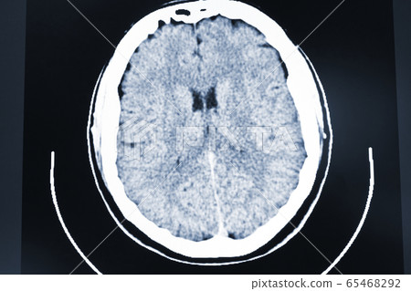 Magnetic scanner of the brain of a patient Magnetic scanner of the brain of a patient 65468292