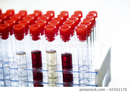 Image of test tube 65502170