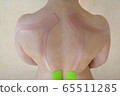 Special physio tape on the back of a young woman, muscle rehabilitation 65511285