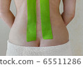 Special therapeutic tape on the back of a woman, muscle recovery, kinesiology tape 65511286