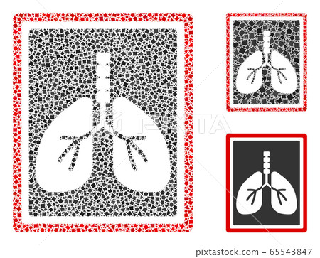 Unequal Lungs X-Ray Photo Icon Collage Unequal Lungs X-Ray Photo Icon Collage 65543847