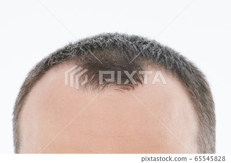 Close up of man bold head Close up of man bold head 65545828