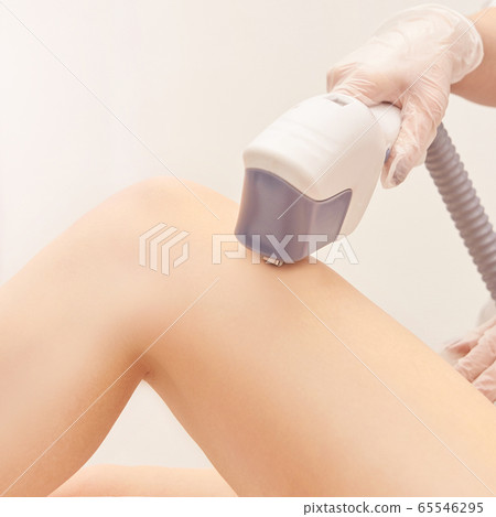 Laser elos medical device. Remove unwanted hair and asteriks. Cosmetology 65546295