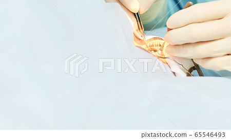 Ophthalmology laser microscope operation. Doctor in clinic. Patient eye Ophthalmology laser microscope operation. Doctor in clinic. Patient eye 65546493