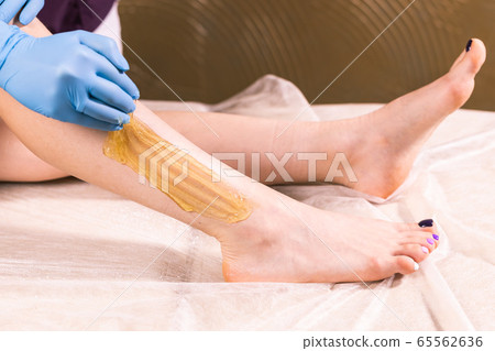 Sugaring epilation skin care with liquid sugar at legs close-up. You can see her smooth and hair free legs after hair removal. Beauty and cosmetology concept. Sugaring epilation skin care with liquid sugar at legs close-up. You can see her smooth and hair free legs after hair removal. Beauty and cosmetology concept. 65562636